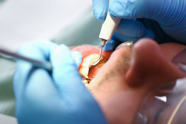 Best Chipped Tooth Repair Near Me  in Reedsville, WI